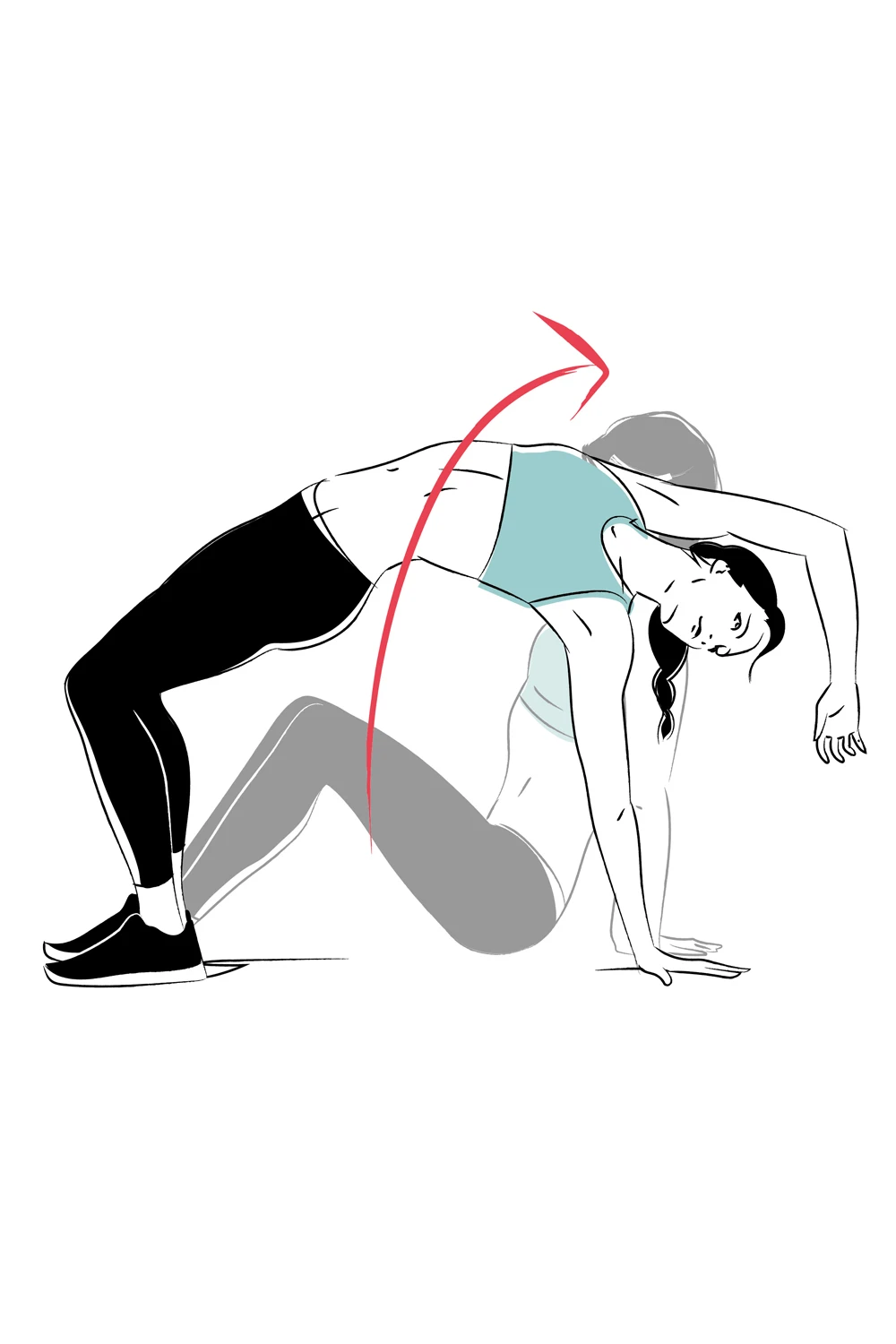 thoracic bridge illustration